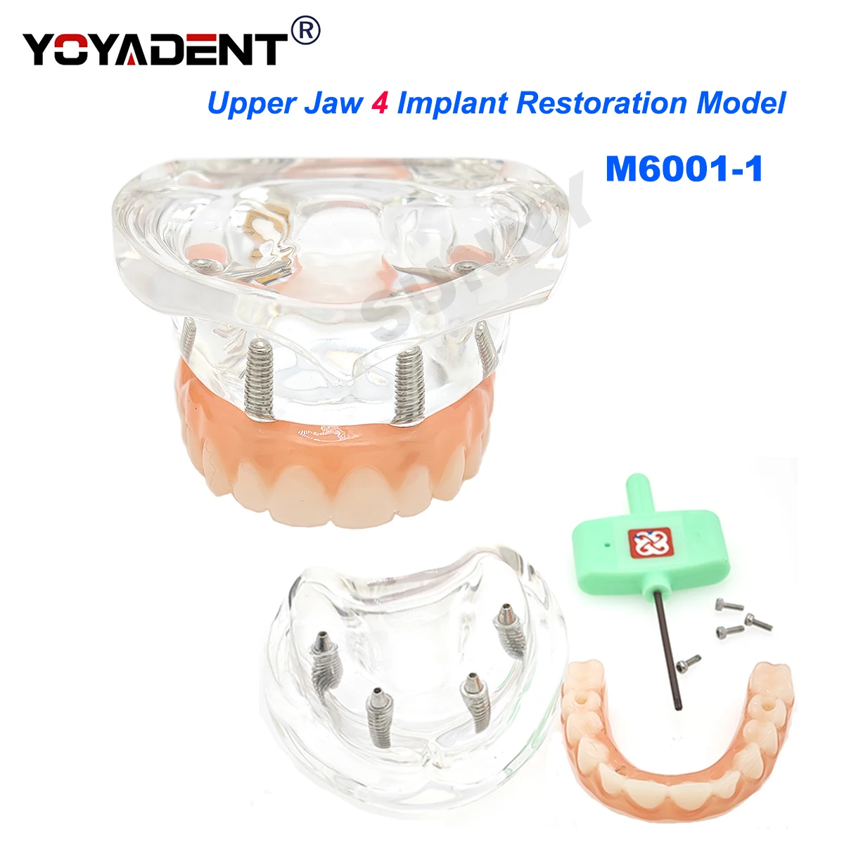 Dental Implant Teeth Model Transparent Upper/Lower Jaw Type  4 Overdenture Modle With 4 Removable Screws Dentist Teaching Model