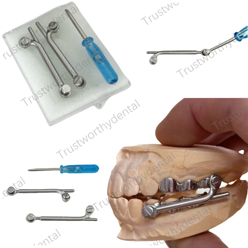 Dental Herbst Appliance Set Dentaurum Sockel Schraube Teleskop kiefer ortho pä dische Klasse II Korrekturen