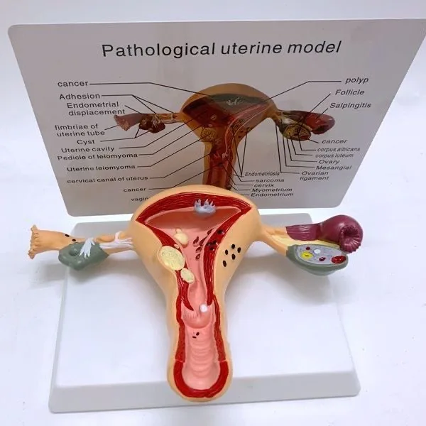 Female Reproductive Model Female Reproductive Model Private Uterus Model Teaching Aid Gynecological Ovary Pathology Model