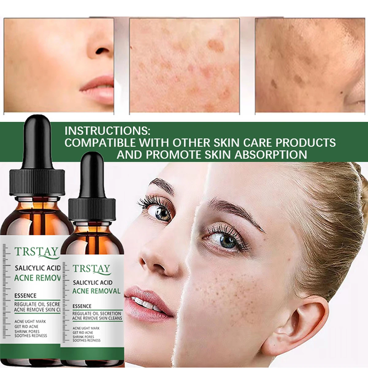 

SALICYLIC ACID ACNE REMOVAL ESSENCE REGULATE OIL SECRETION ACNE REMOVE SKIN GLEANS Promote skin absorption