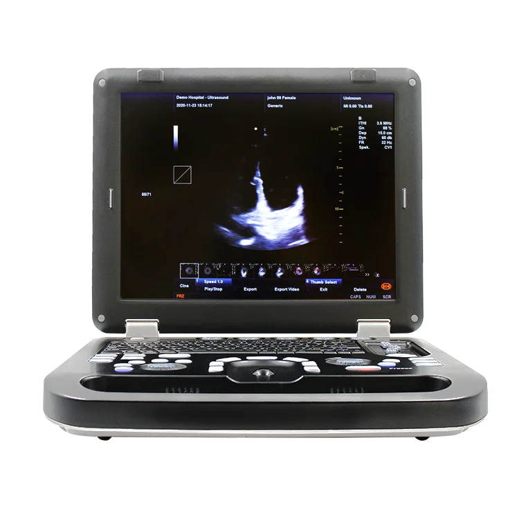 Contec CMS1700C Color Doppler Ultrasonic Diagnostic System usg machine