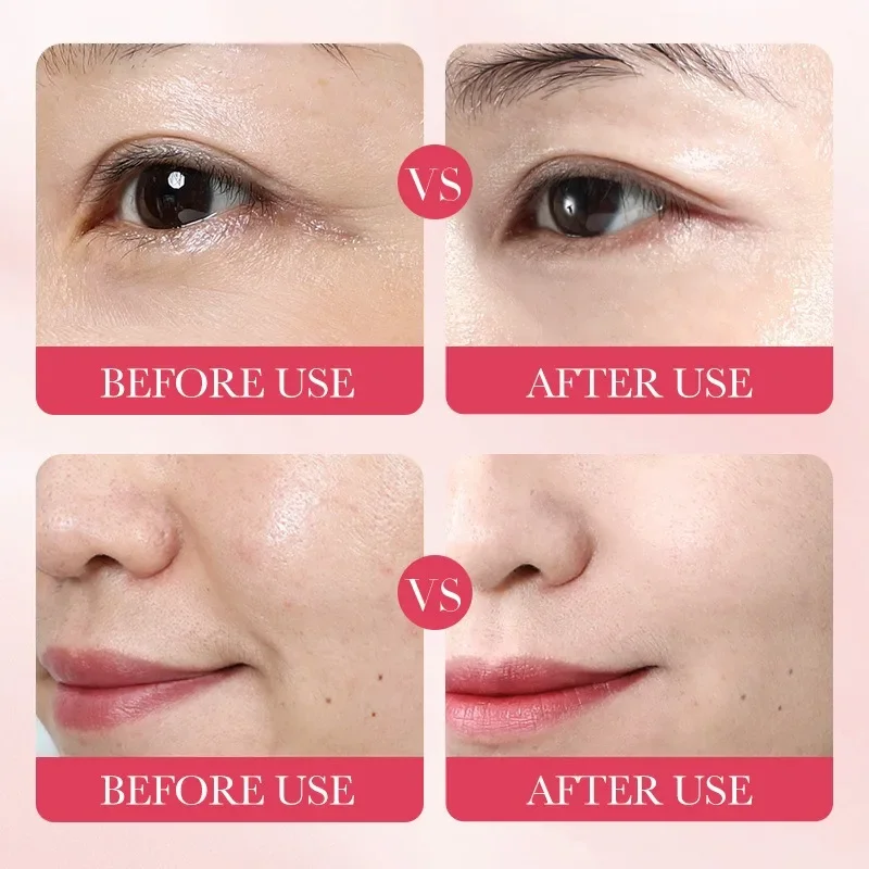 5/10 قطعة الكورية الحلزون Mucin ورقة قناع ترطيب إصلاح اشراق مكافحة الشيخوخة التجاعيد ترطيب هلام قناع الوجه لجميع الجلد