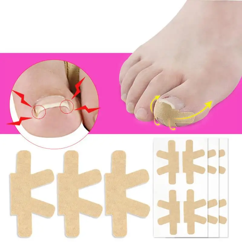 3Sheets Ingrown Toenail Tape Toenails Brace Sticker Correction Patch Tool Corrector Pedicure Care Tool Aid Relief Pain