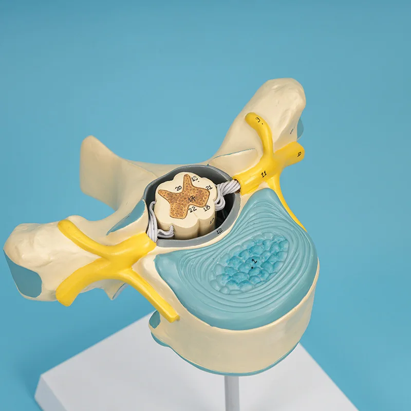 نموذج تكبير الحبل الشوكي للعمود الفقري والعمود الفقري، نموذج طبي للحبل الشوكي الصدري