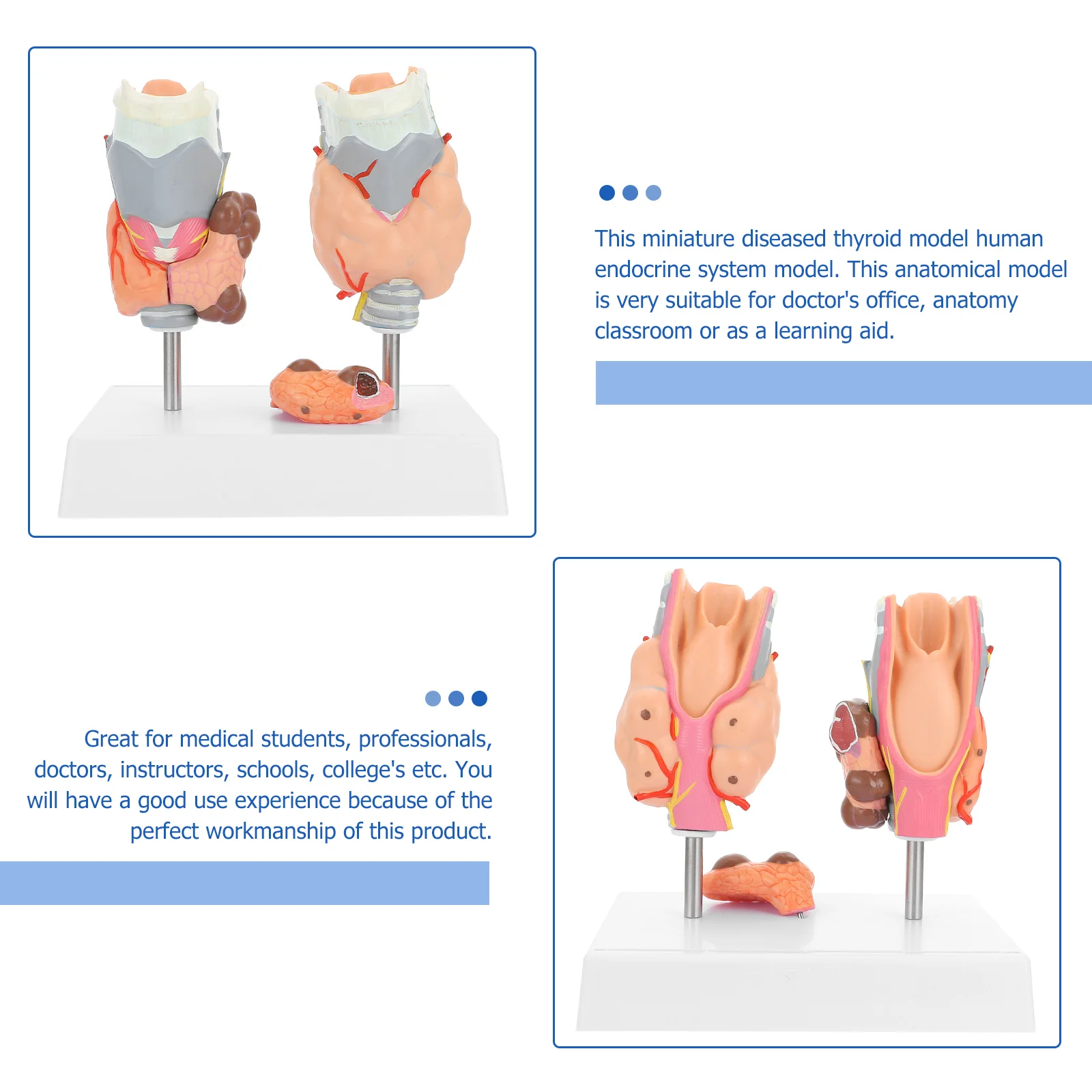 Model Patologi Tiroid Model Pengajaran Model Anatomi Model Sistem Endokrin Model Patologi Plastik Model Tiroid Plastik