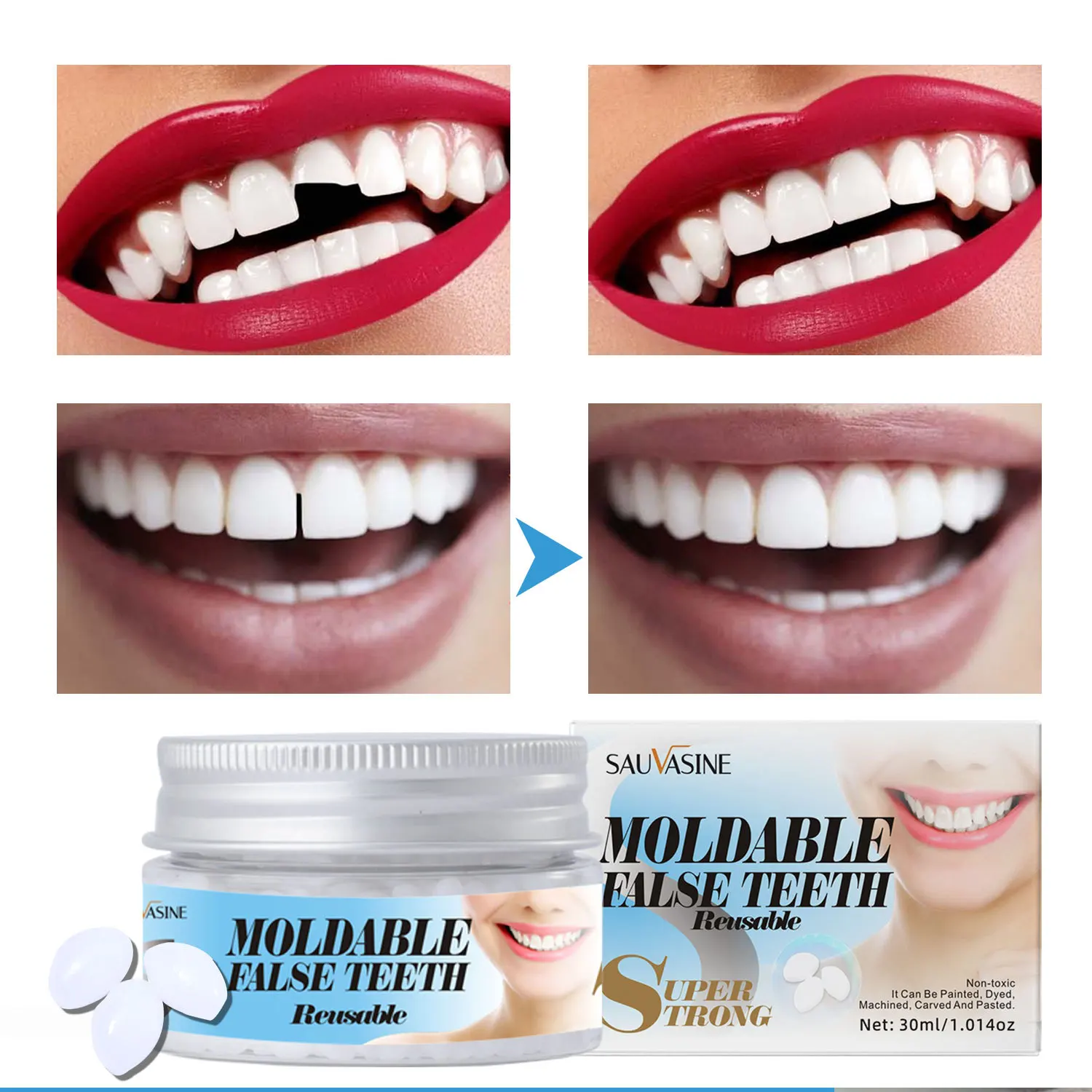 Moldable False Teeth Reusuble Non-toxic DIY False Teeth Excessive & Broken & Missing Teeth, 30g