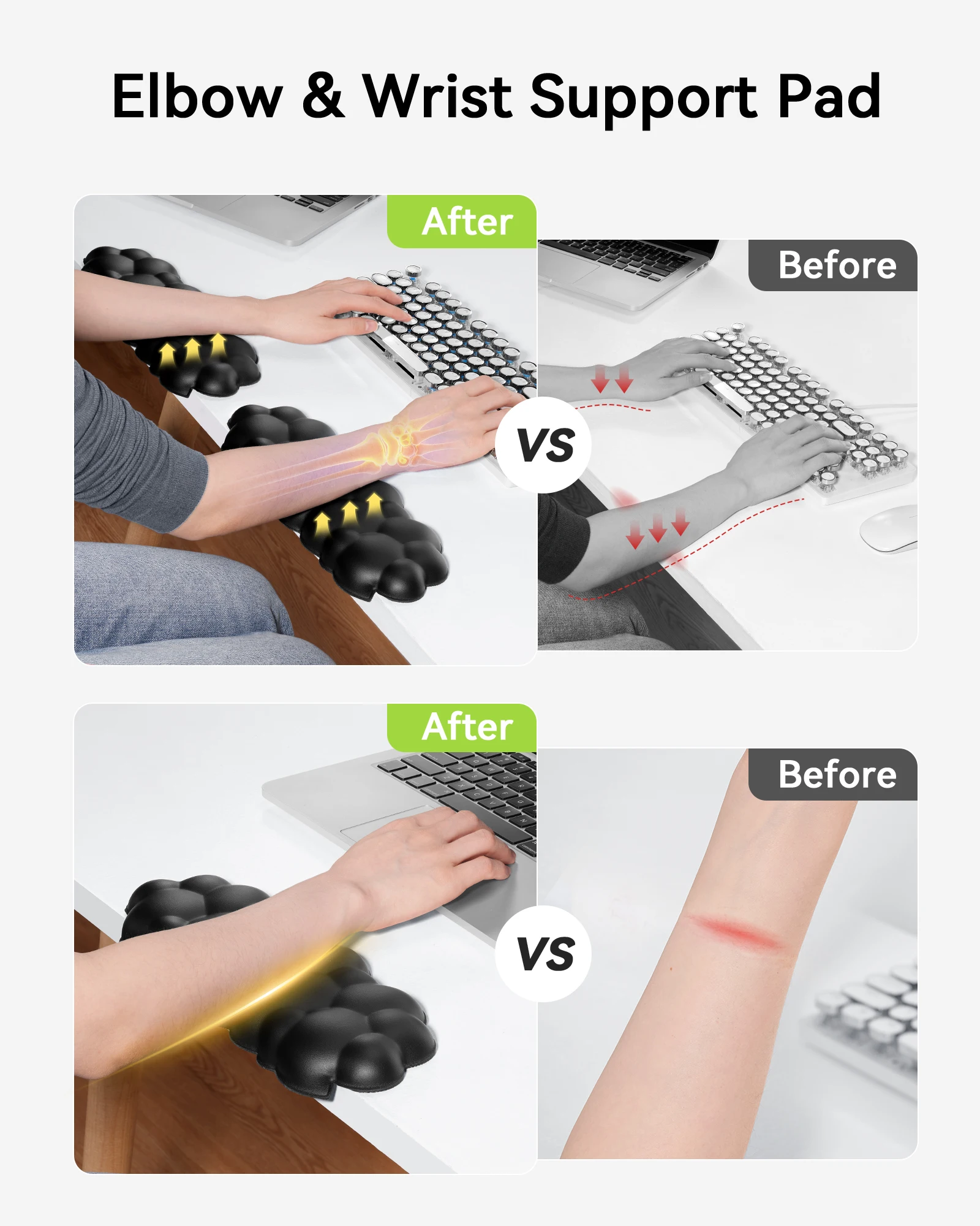 Elbow Pad for Desk, 2-Pack L-Shaped Desk Edge Arm Rest Cloud Wrist Rest, Non-Slip Memory Foam Arm Pads, Wrist Support