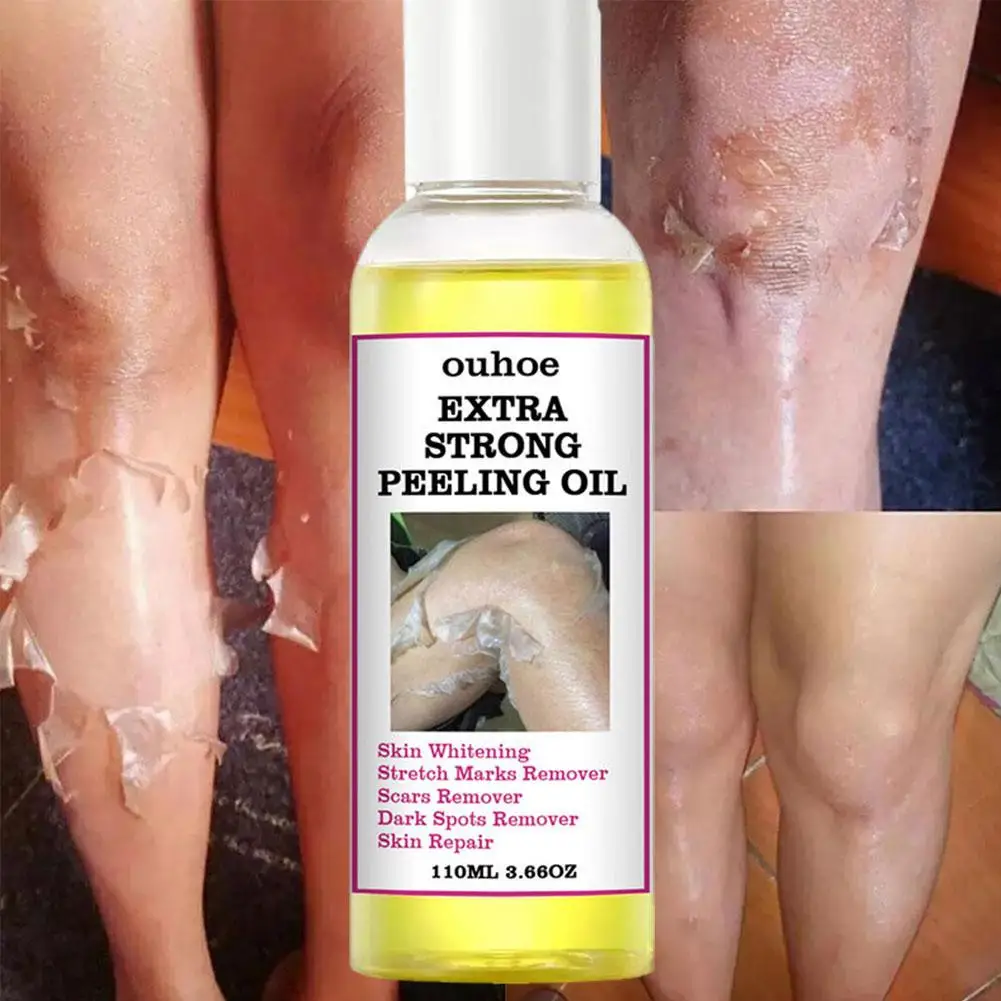 30/110ml Peeling Oil Elbow Knee Finger Exfoliating Removes Dead Skin Brightening Skin Tone Moisturizing Tighten Body Skin Care