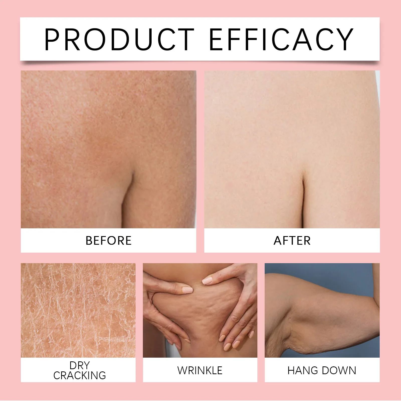 زيت الورك الوردي زيت الجسم الفاخر ترطيب عميق تخفيف جفاف كامل الجسم تجديد ثبات الجلد زيت تدليك الجسم المرن