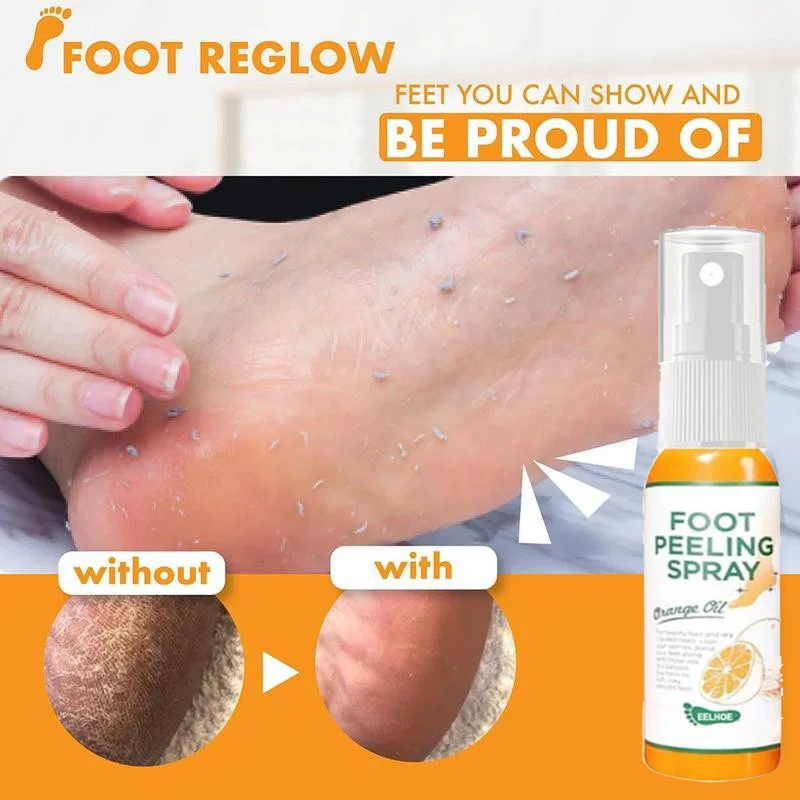 

30ml Foot Care Spray To Remove Dead Skin on Foot Exfoliating Spray Elbows and Knees To Remove Calluses and Crusty Foot Foot Spa