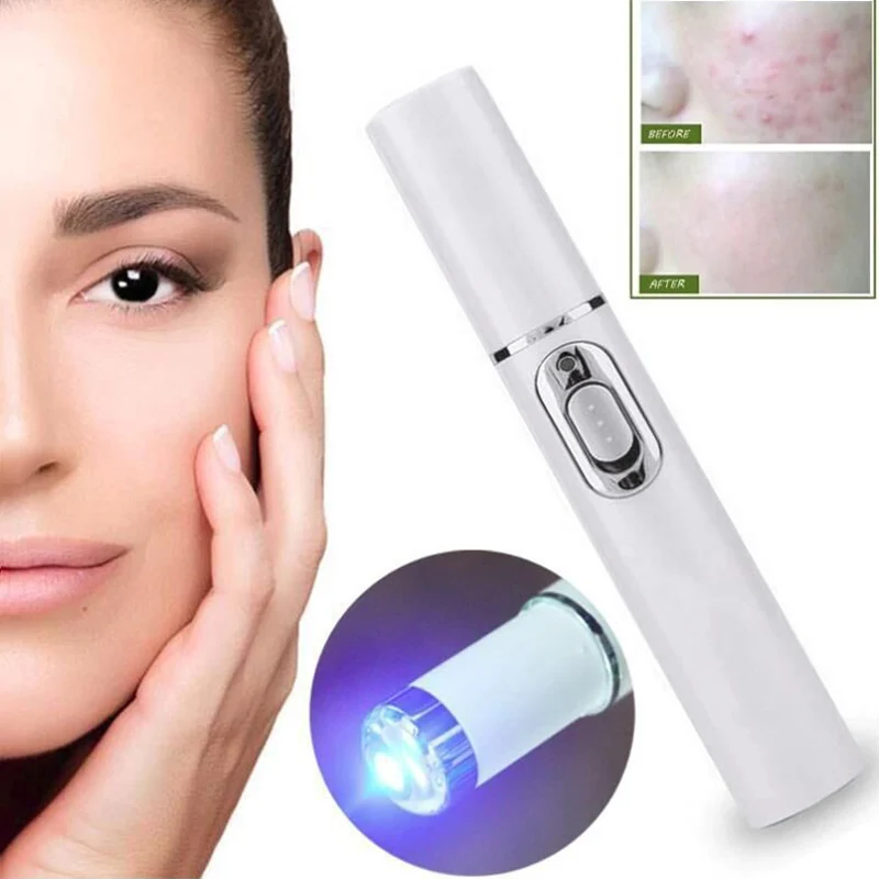 Portable Acne Treatment Pen Activates The Skin & Tightens Loose Skin for Oily Skin & Heavy Sensitive Skin