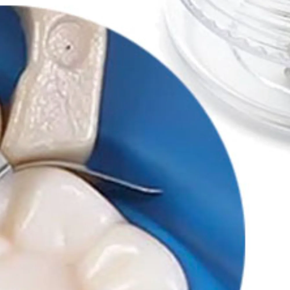 

50 шт., стоматологические секционные матричные ленты, контурные металлические полоски с твердостью и эластичностью, инструмент для ухода за полостью рта для стоматолога