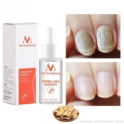 Toenail Repair Essence Anti Infection Nail Fungus Treatments Essence Feet Onychomycosis Repair Essence Supply Unisex 발톱무좀