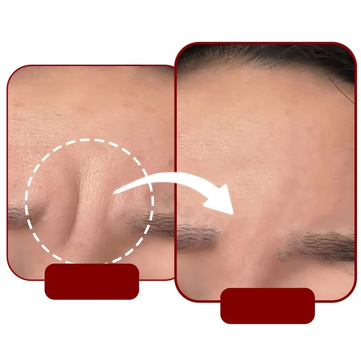 48 Self-Adhesive Sleep Patches for the Forehead - Reusable Elastic Patches for the Face - for the Forehead Only - Suitable for the Entire Face - Washable, Sticky, and Reusable - Compact and Portable - for Daily Use - Suitable for Travel - Unisex