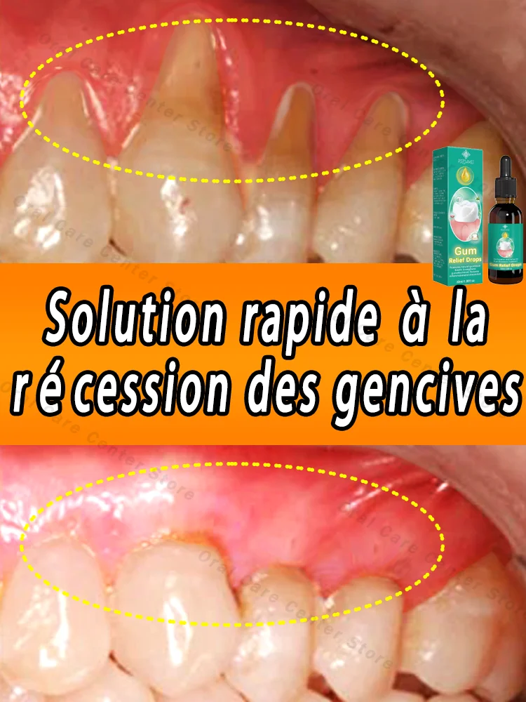 Effectively repair damaged gums, relieve toothache, strengthen teeth and strengthen gums