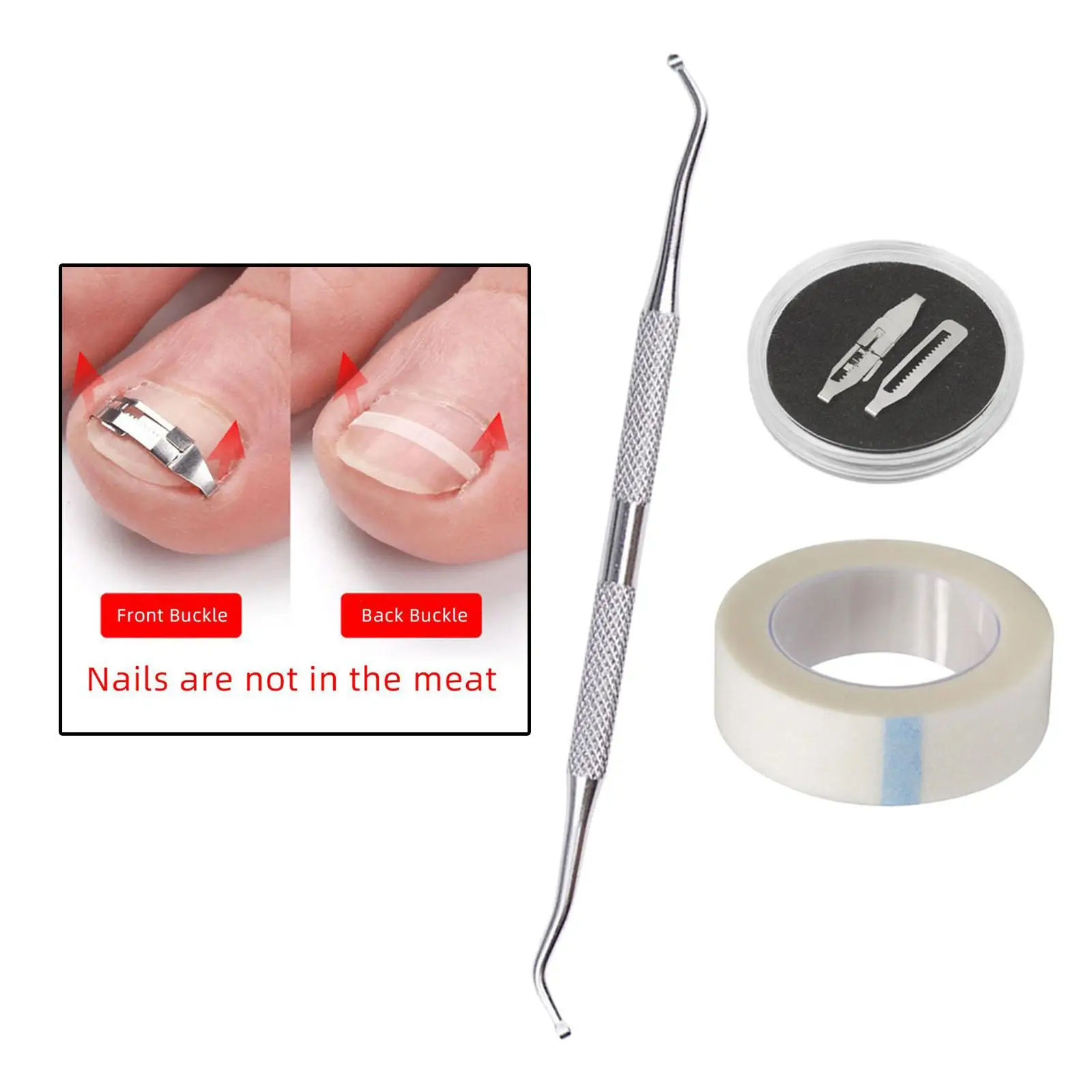 Professionele ingegroeide teennagelcorrectorhulpmiddelen Ingebouwde teennagelsbehandeling