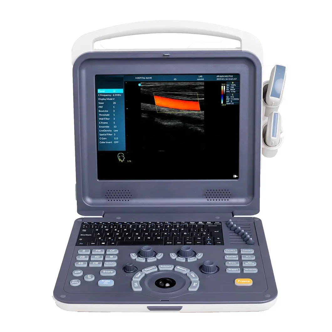 Portable PC Platform Color Full Digital Ultra Sound Scan Portable Laptop Ultrasound Machine