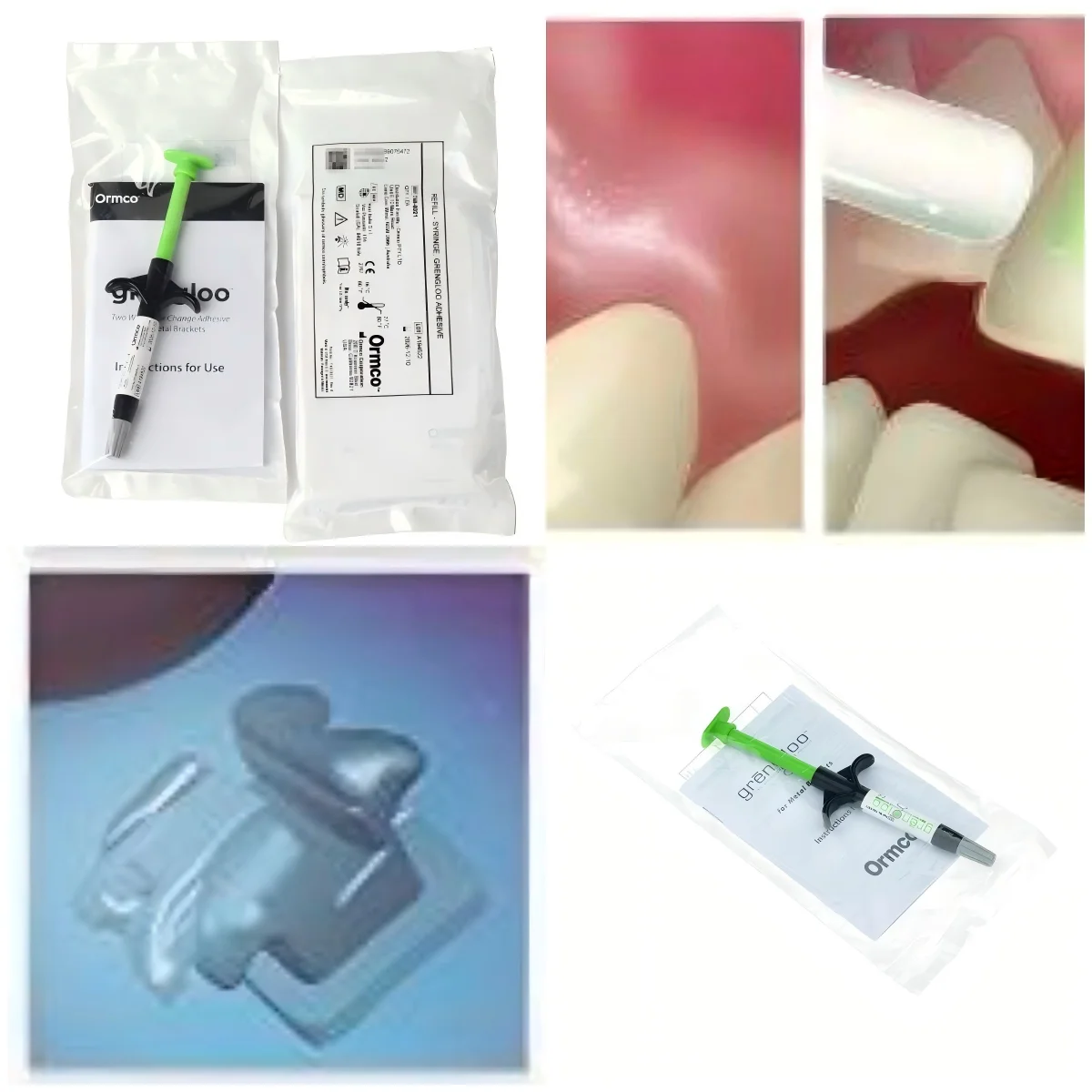 

OORMCO Grengloo Adhesive Light Cure Color Change Orthodontic Resin for Bracket Placement Bonding Adhesive Dental Bonding Tool