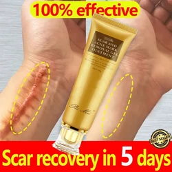 Fast Scar Removal Cream Effective Treatment Stretch Marks Burn Surgical Scars Acne Spot Repair Whiten Moisturize Herbal SkinCare