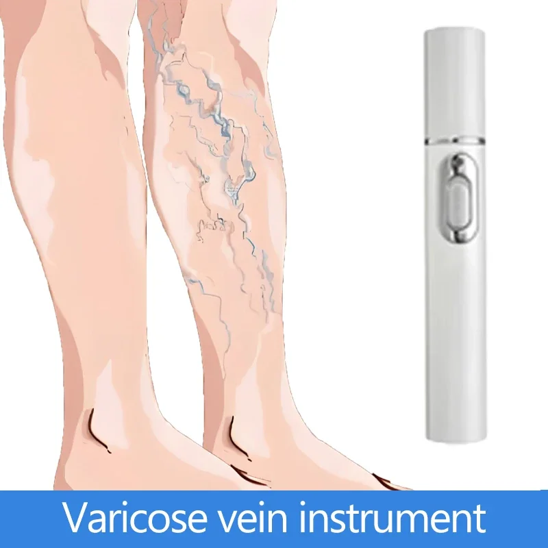

Varicose Veins Instrument for Varicose Vein Prevention in Elderly Care Homes - Long - Term Health
