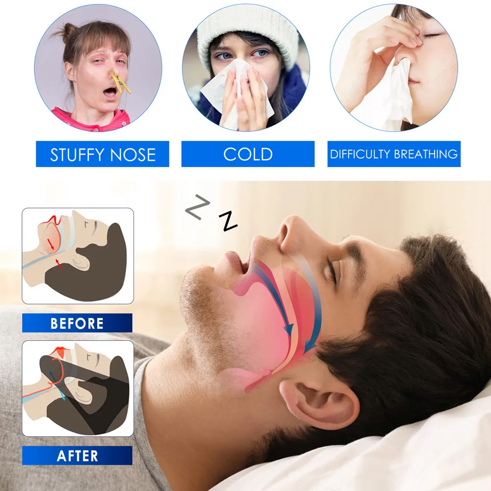 1/2/3/4/5Pcs Silicone Anti Snoring Nasal Dilator Stop Snore Nose Clip Aid Opens Nose to Breathe Easily Improve Sleeping Rhinitis