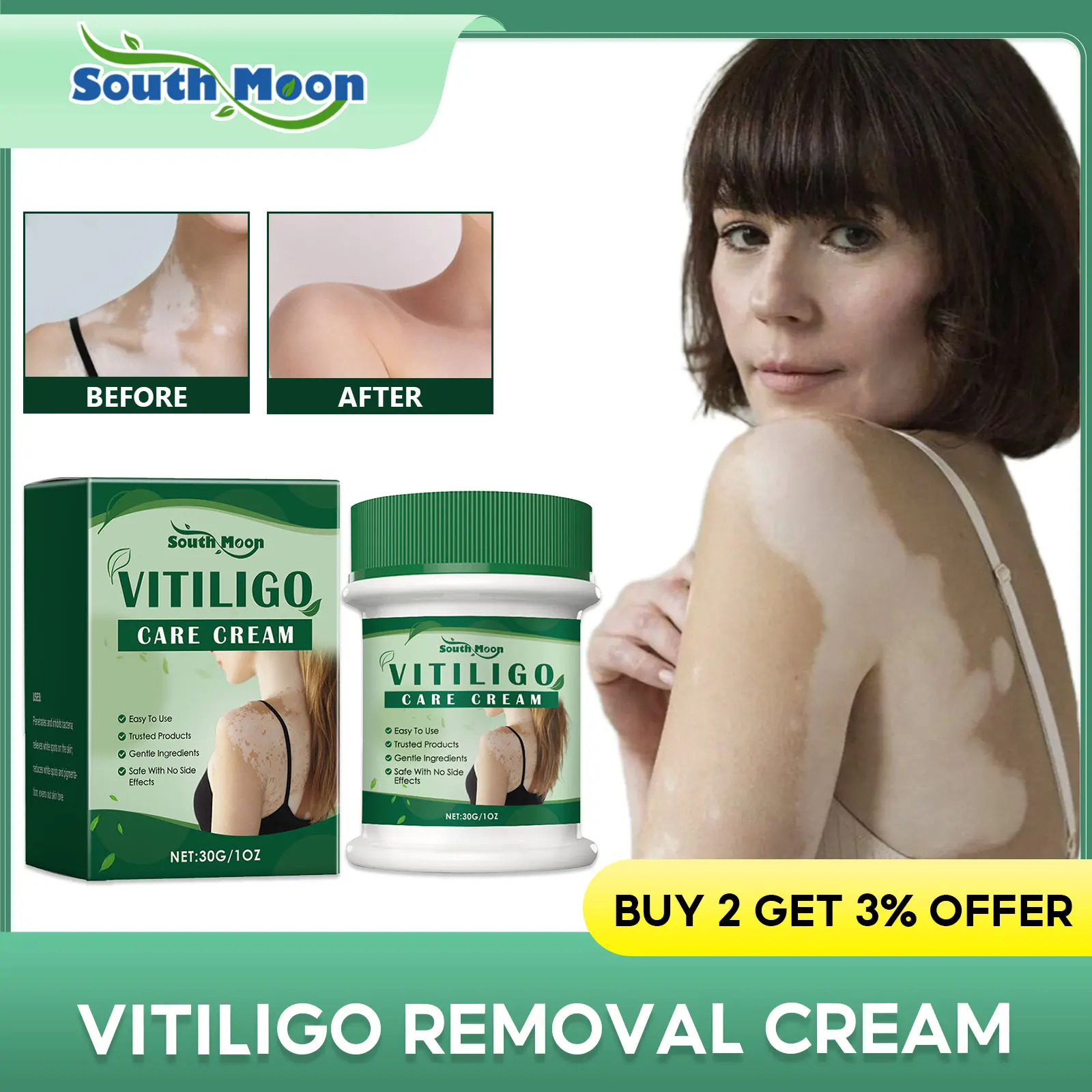 ﻿White Spots Removal Cream Repair Skin Vitiligo Enhance Melanin Even Skin Tone Prevent Spread Leukoplakia Treatment Ointment