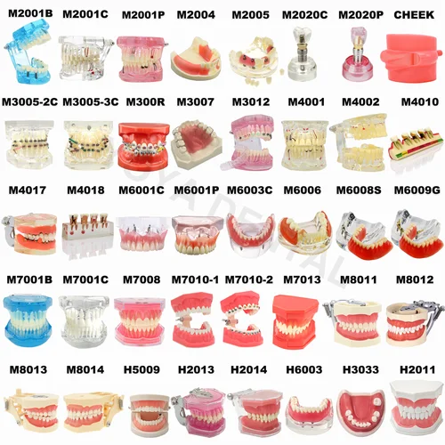 Varios tipos de modelos dentales, modelos de enseñanza Dental, estudio, ortodoncia, dientes extraíbles, modelos de implante, Material de dentista