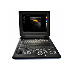 12 Inch Advanced 3D Color Doppler Medical Portable Laptop Notebook Pregnancy Ultrasound Scanner Machine