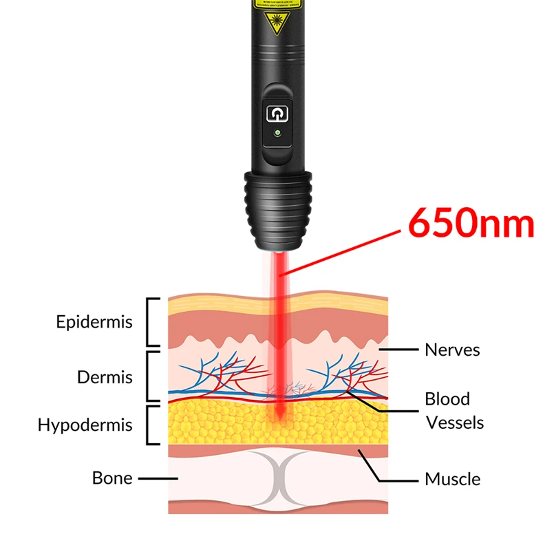 100mW Acupuncture Pen Laser Dog Therapy Laser Handy Cure Cold Laser Infrared Cold Laser Speed up Wound Healing Tendon Injuries