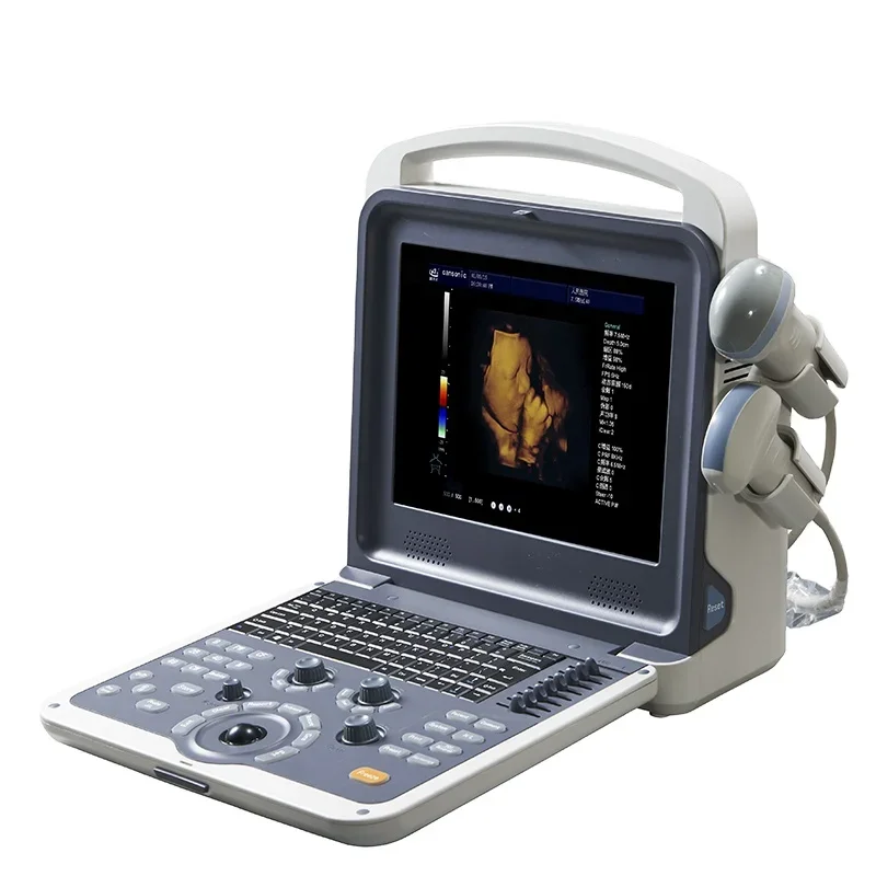 HC-A011 newest portable 4D color doppler ultrasound system/usb laptop ultrasound scanner/wireless ultrasound scanner