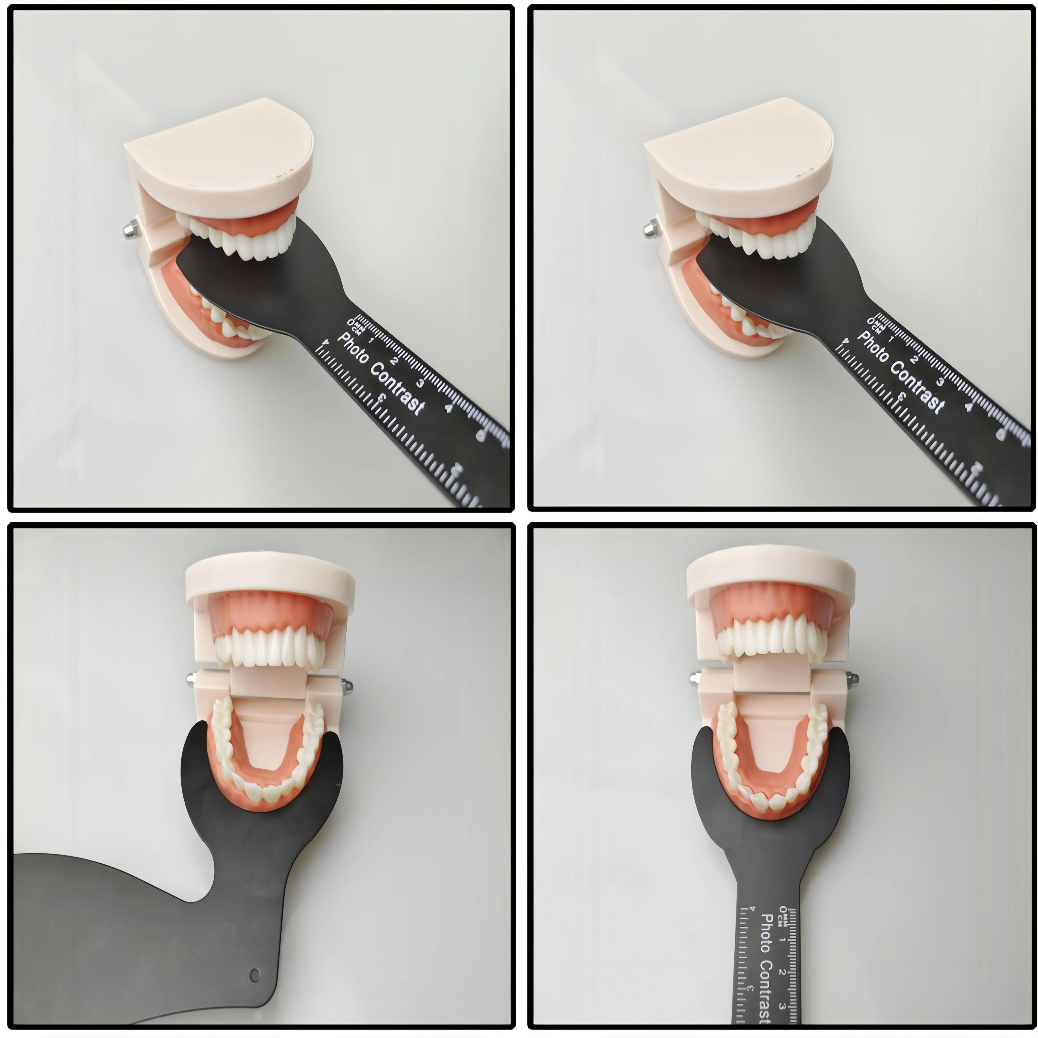 Dental Photo Contrast Black Background Board Autoclavable Dental Contrast Intraoral Photographic Mirror
