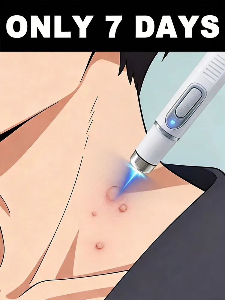 

При продолжительном использовании бородавки постепенно отпадают. Доступны дополнительные скидки при покупке комплекта.