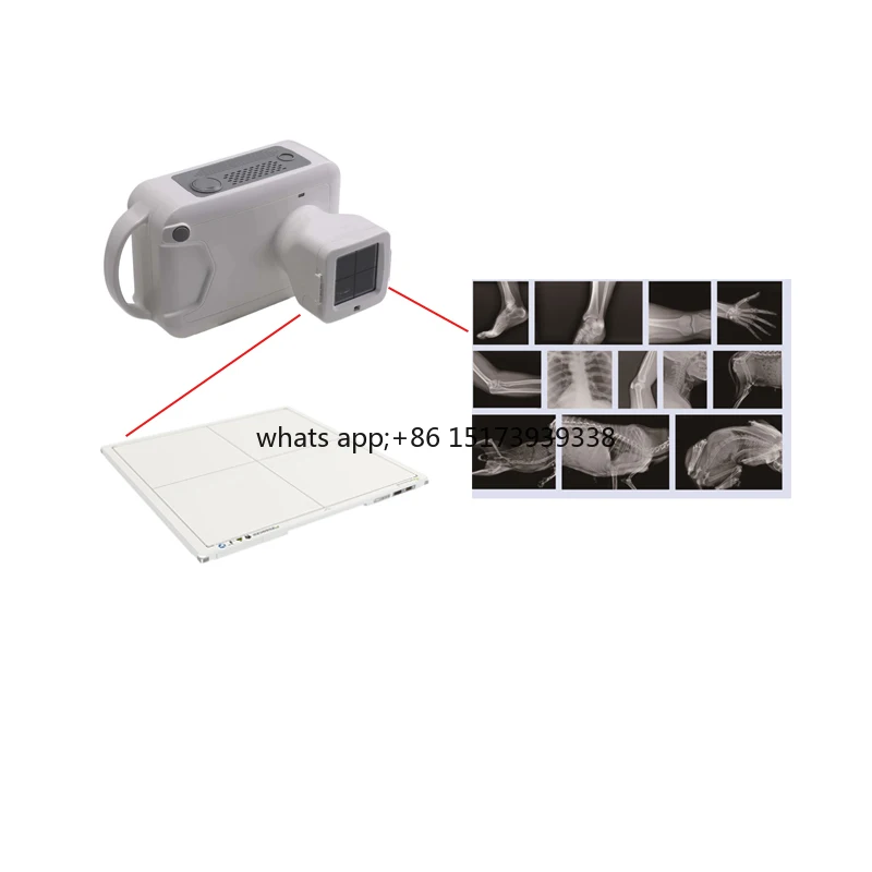 

Digital Panel Detector Hand Held DR X-Ray Human Veterinary Medical Portable for Different