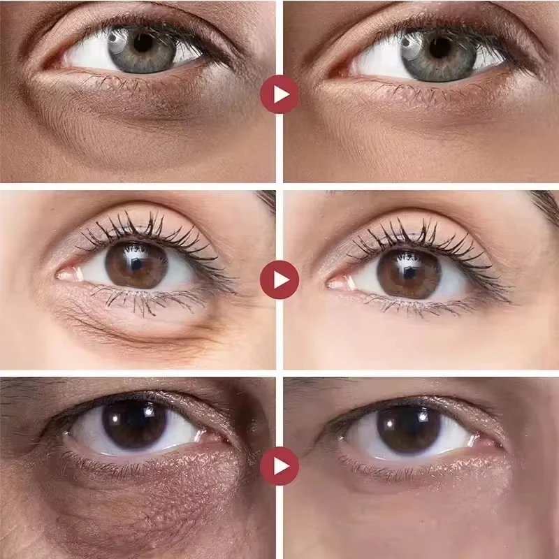 Retinol Eye Cream Collagen Multibalm Stick Reduce Wrinkles Eye Bag Hyaluronic Acid Anti Dark Circle Puffiness Eye Care Products