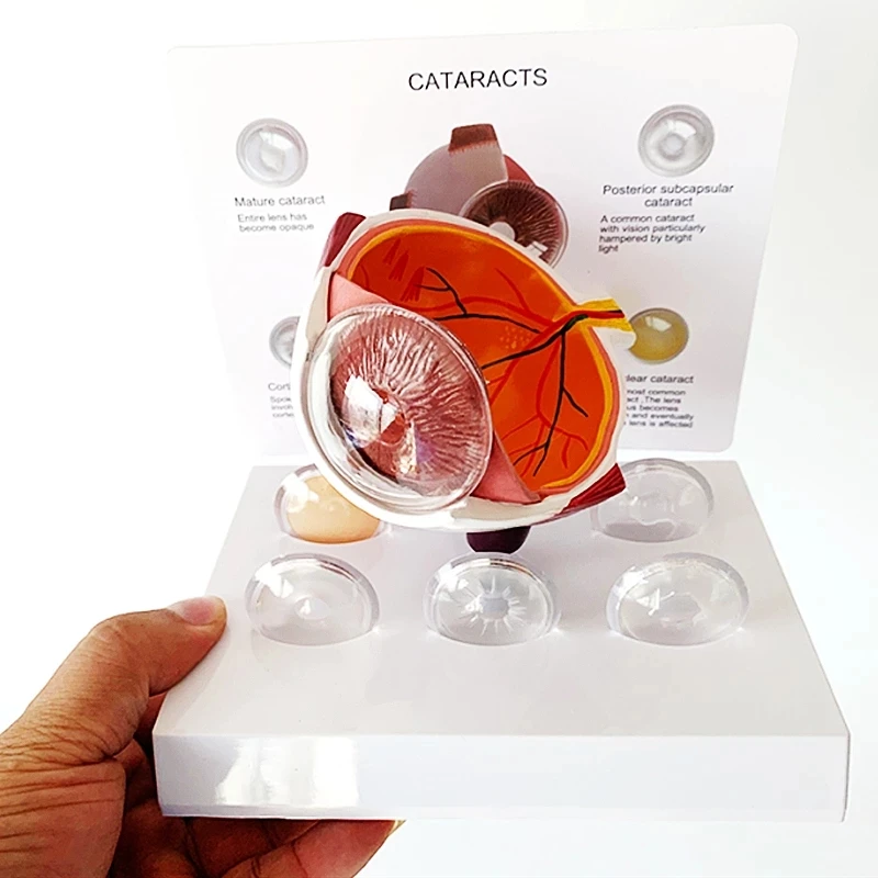 Cornea Eyeball Model Human Eye Model Human Eye Demonstration Teaching Prop Cataract Anatomy Medical Teaching Model