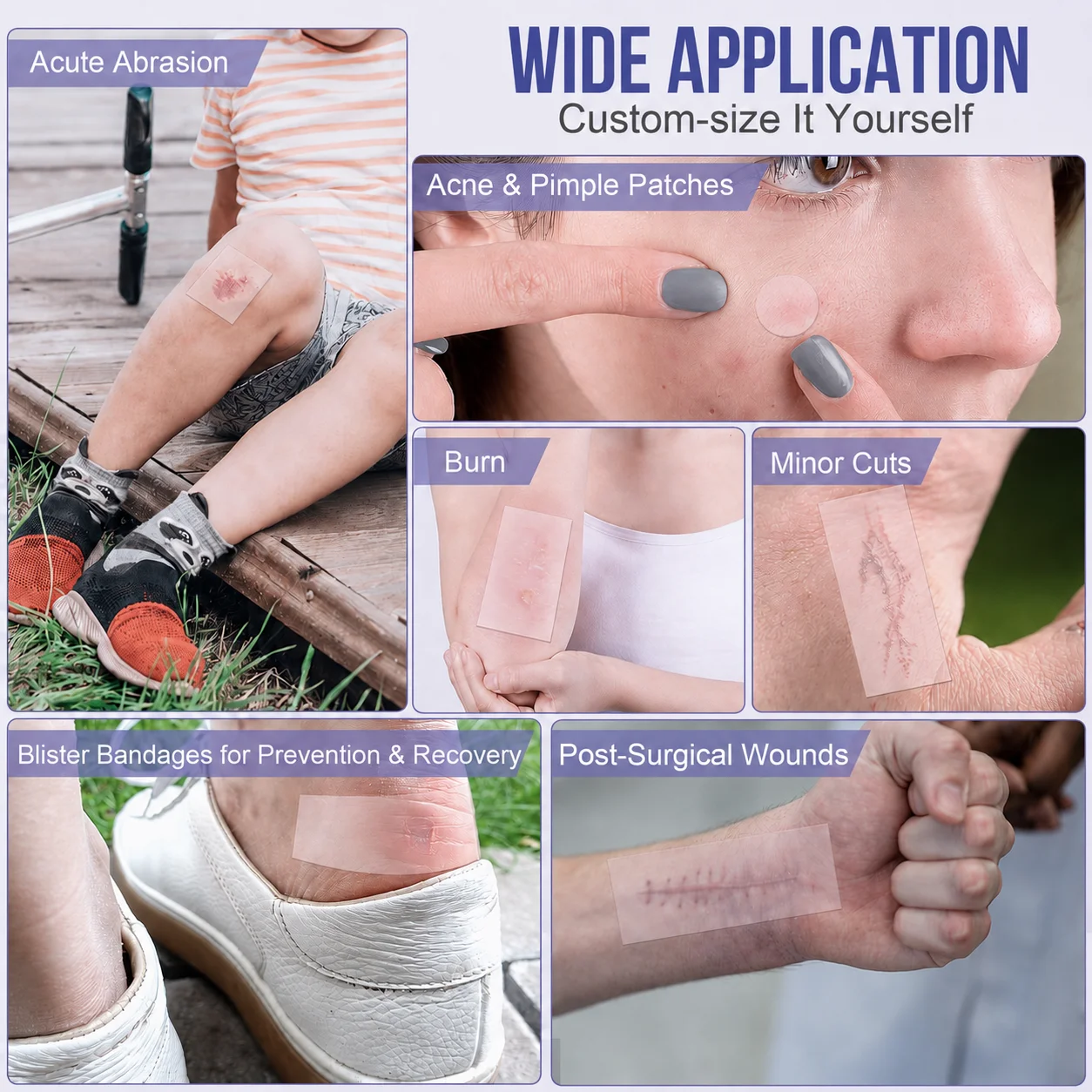 1 Roll of Hydrocolloid Wound Care Roll, Self-Adhesive Waterproof Absorbent Bandage for First Aid Use.