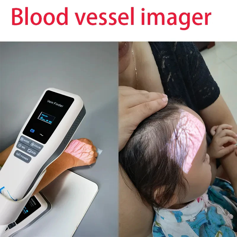 Medical Beauty Salon Face Vein Locator Aesthetic Clinic Use Handheld Infrared Vein Viewer Finder