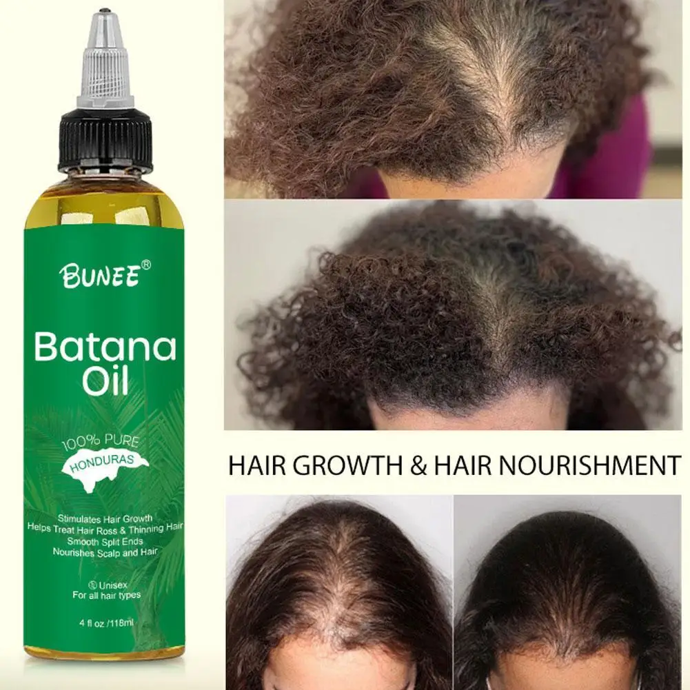 

Natural Batana Oil For Hair Growth Anti Loss Repair Hair Root Moisturize Strengthen Improve Split End Hair Health Thicker Care
