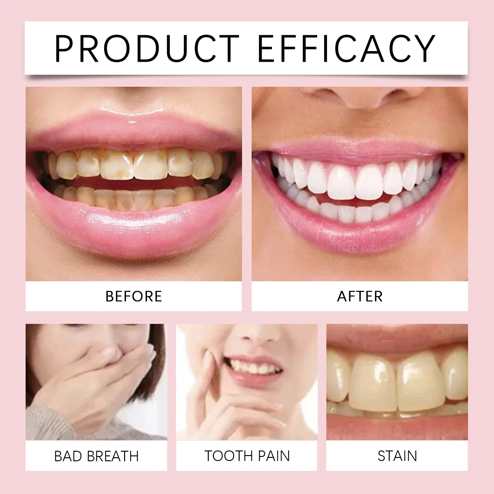 Probiotic Toothpaste SP-6 Whitening Tooth Remove Plaque Stains Teeth Whitener Oral Hygiene Clean Fresh Breath Denta 120g New