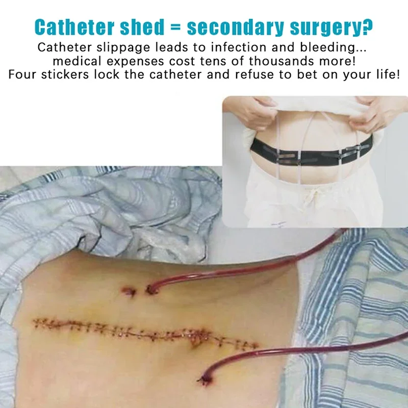 Adjustable Peritoneal Dialysis Waist Belt Black Catheter Protector Abdominal Belt With Catheter Fixation Device Conduit Strap