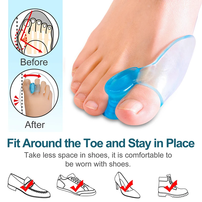 Siliconen Teen Separator Vingervoetjes Zorg Beschermer Gel Teen Orthopedische Bunion Hallux Valgus Corrector Pedicure Spacer