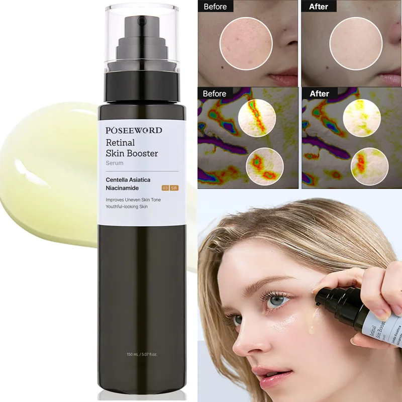 150ml Glow Intensive Retinol Skin Boosting Serum Fading Dark Spot Balancing Skin Tone Improve Fine Line Brightening Skin care