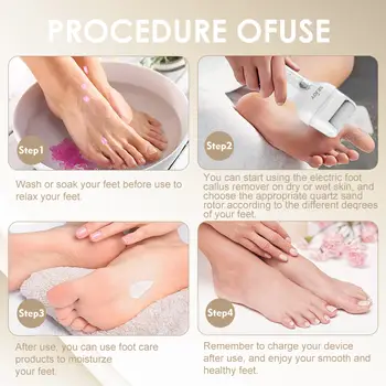 SEJOY Elektrický odstraňovač mozolů na nohou Elektrický pedikérský stroj s nastavitelnou rychlostí a 2 náhradními brusnými papíry Pedikúra nohou 10 nejlepší prodej elektrická bruska na nohy - №10