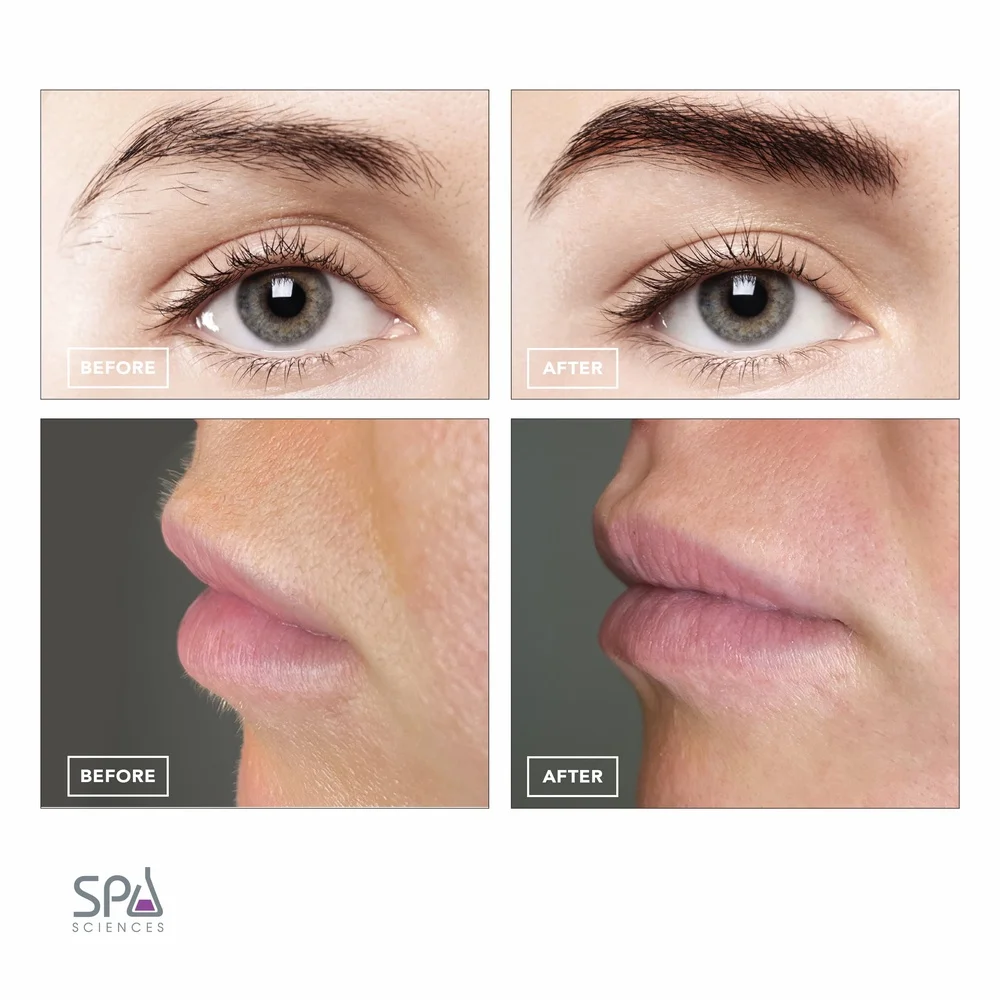 جهاز إزالة شعر الوجه 2 في 1، ماكينة تشذيب الحواجب، جهاز إزالة الشعر بإضاءة LED قابل لإعادة الشحن عبر USB مع أطراف مطلية بالذهب