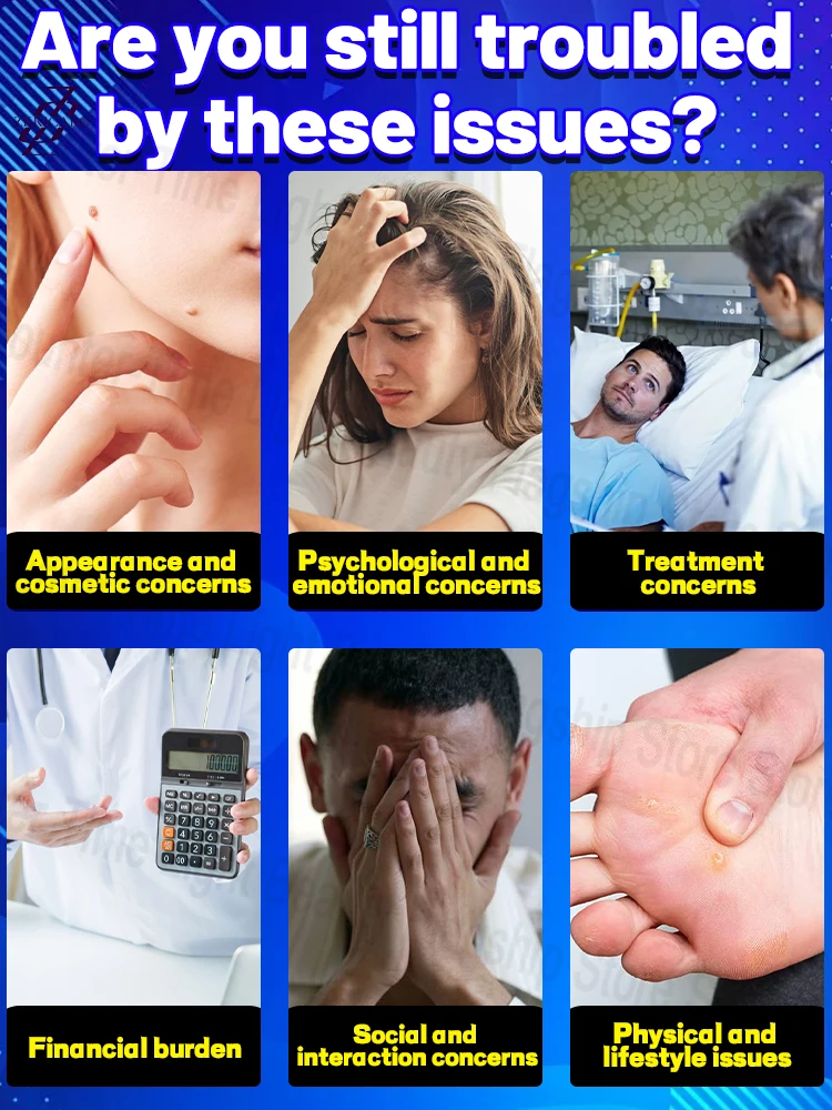 إزالة الثآليل الضوئية، استعادة البشرة الناعمة، إزالة الثآليل الدقيقة، فعالة وخالية من القلق #2