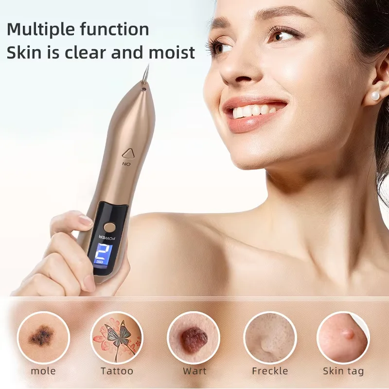Lᴀsᴇʀ ᴛᴀᴛᴛᴏᴏʳᵉᵐᵒᵛᵃˡ⸴including eyebrow tattoo removal and large tattoos, can be performed quickly and effectivel