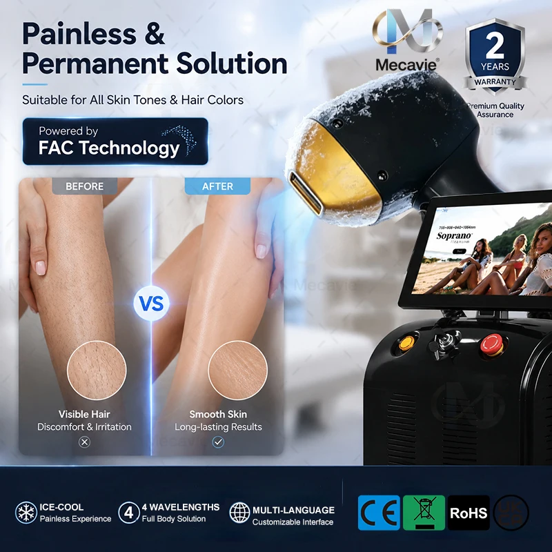 Professional Triple 4 Wave Ice Platinum Diode Laser Hair Removal Laser 6000W 755 808 1064nm Diode Laser Hair Removal Machine
