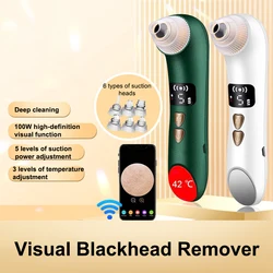 Smart Visual Blackhead Remover Hot and Cold Compress Acne Cleaner Sturdy Blackheads Acne Remover Face Deep Cleansing with Camera