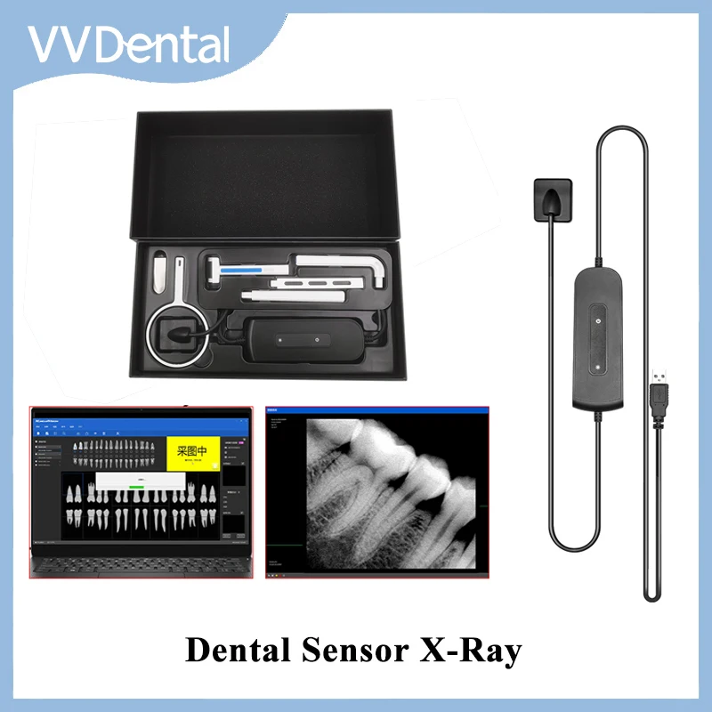 Dental RVG Sensor Intraoral lmaging System HD lmage X-Ray Radiovisiograph High-Frequency Digital Sensor Dentistry Tools