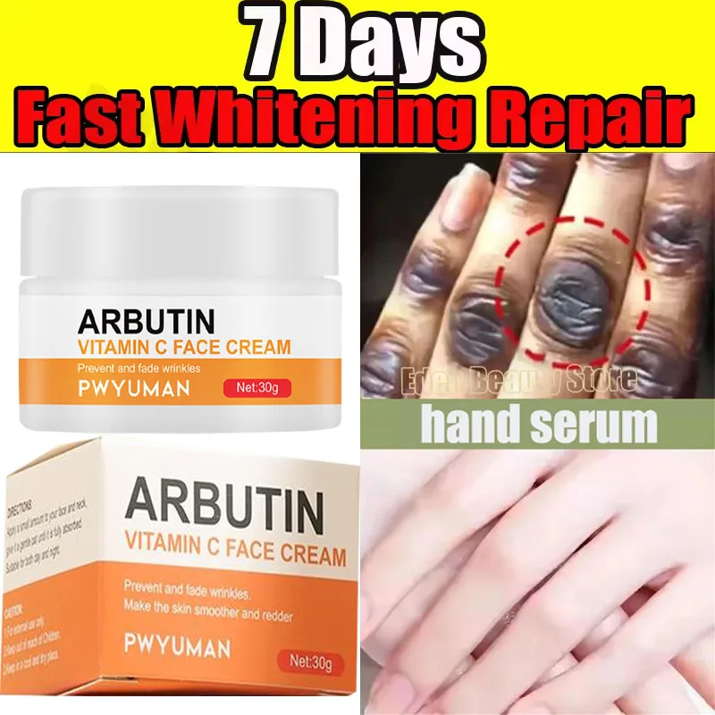 

Fast Whitening Dark Knuckles Brighten Hand Cream Melanin Corrector Moisturizing Intense Stains Remover Products Skin Care